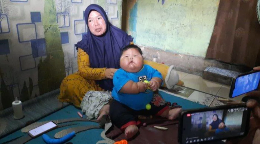 Gambar Artikel Viral for Obese Babies Given Sweetened Condensed Milk, UM Surabaya Nutritionist Calls 5 Impacts